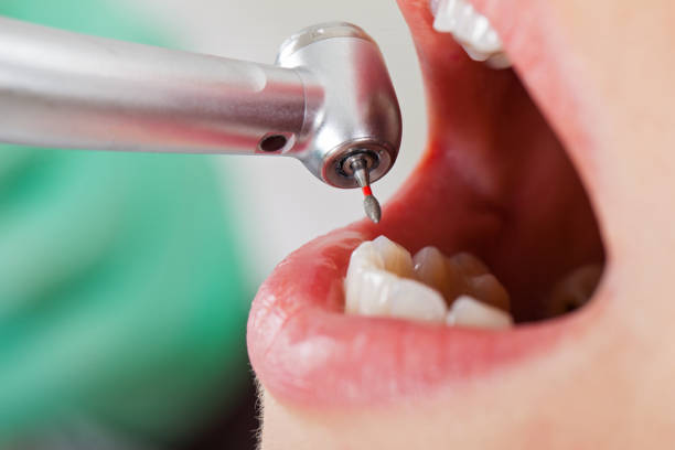 Best Pediatric Emergency Dentist in Carbon Cliff, IL